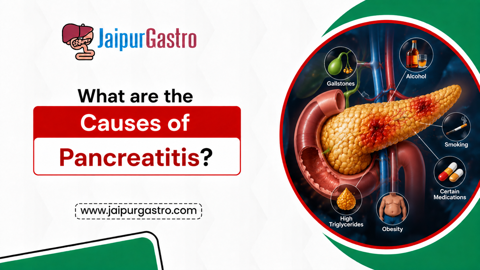 causes of pancreatitis