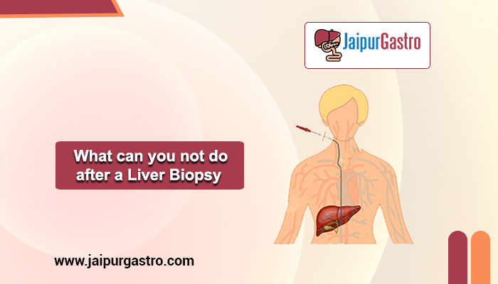 not do after a Liver Biopsy