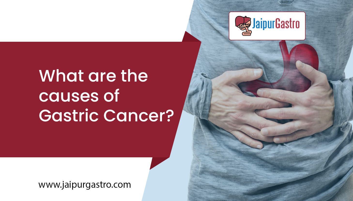 causes of gastric cancer