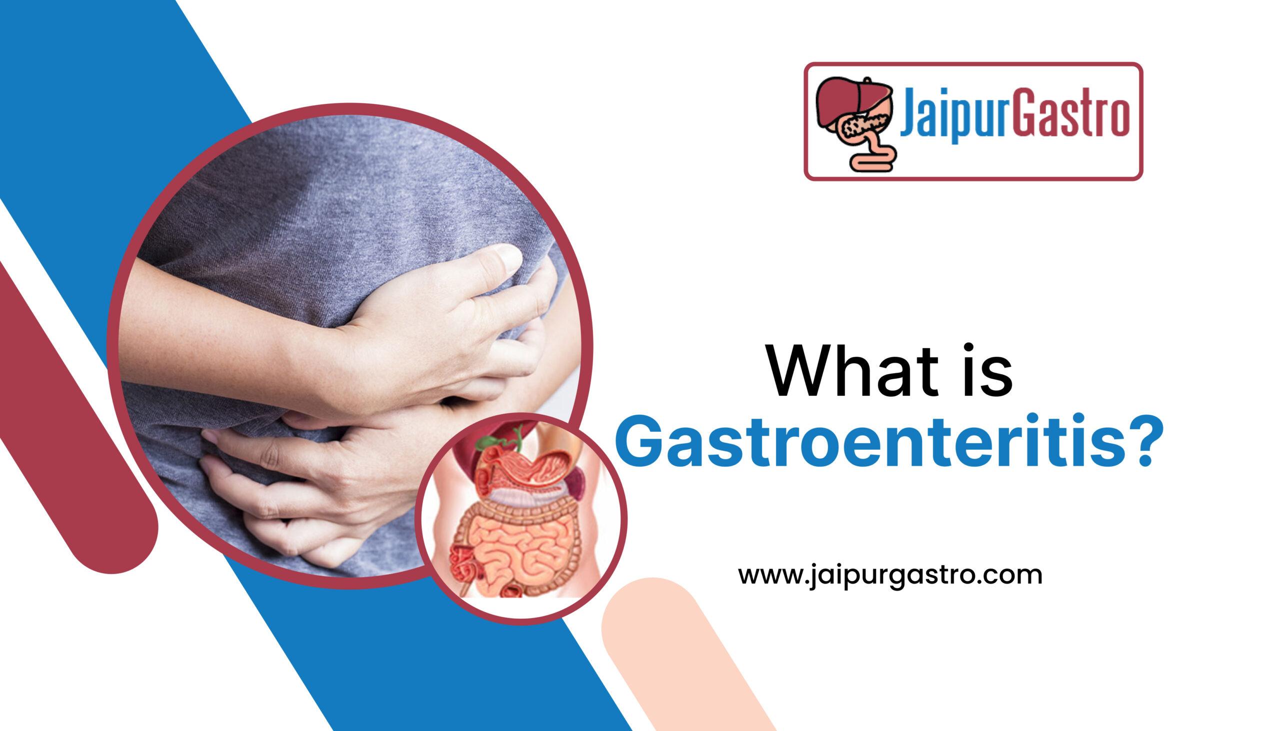 What is gastroenteritis