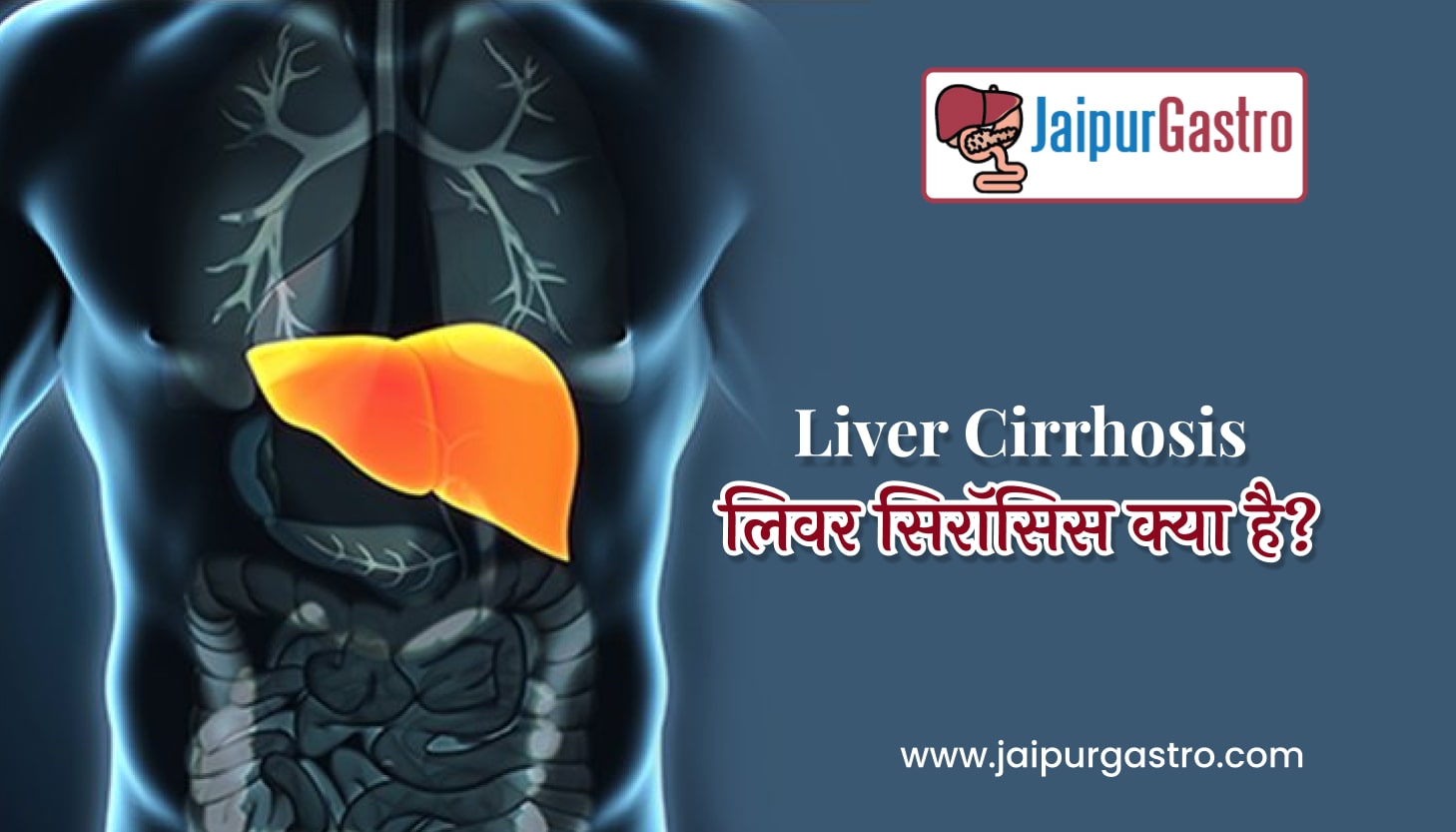 Liver Cirrhosis Meaning in Hindi