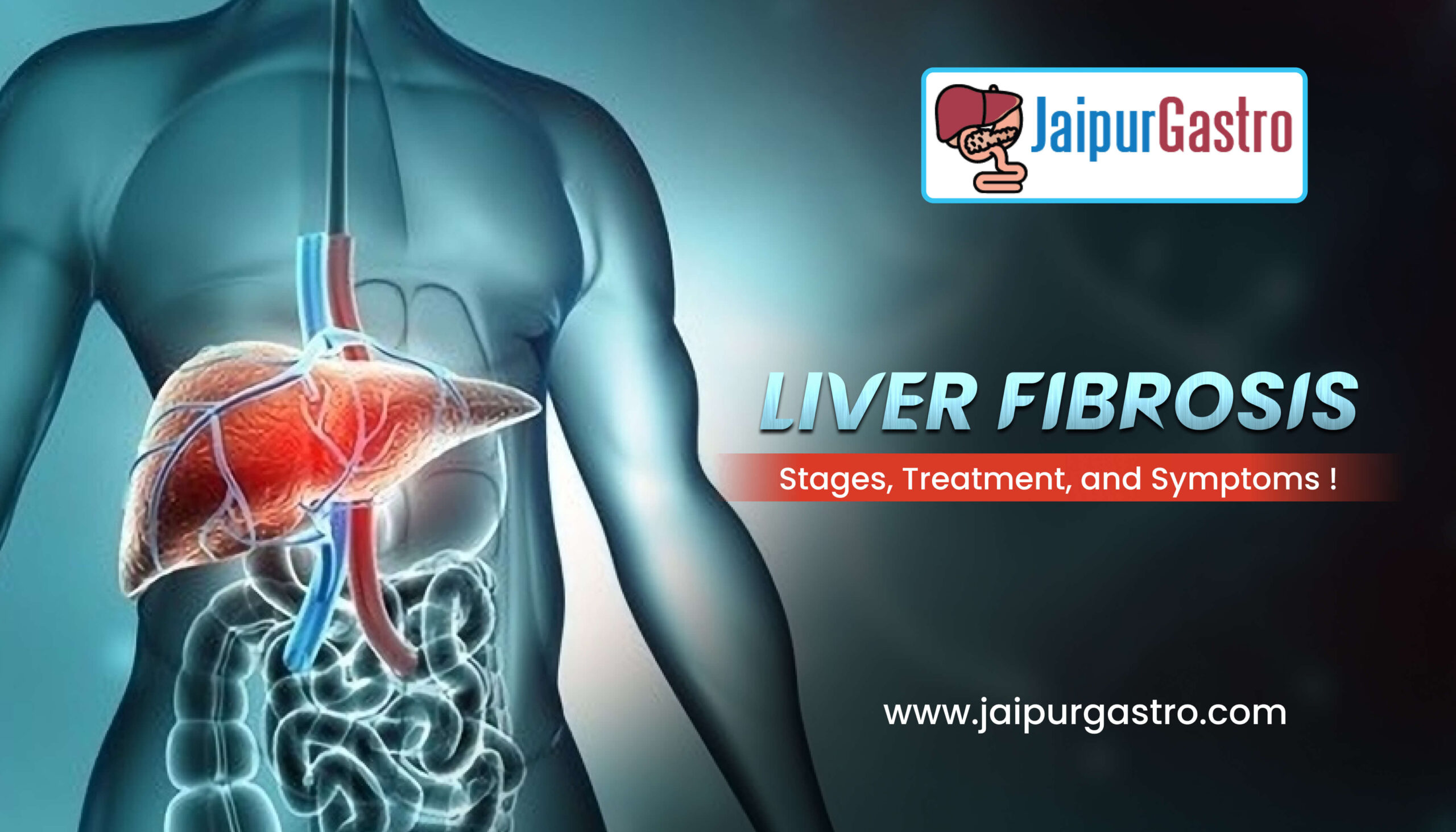 What is Liver Fibrosis