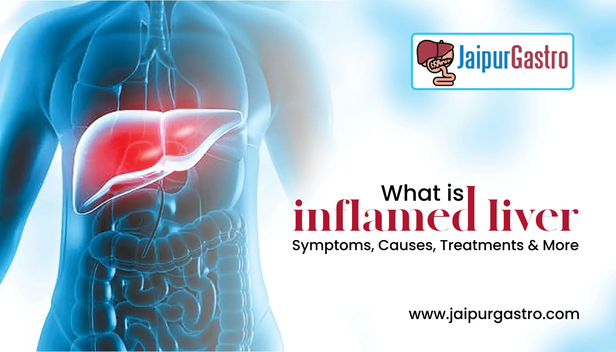 What is inflamed liver - Symptoms, Causes, Treatments & More?