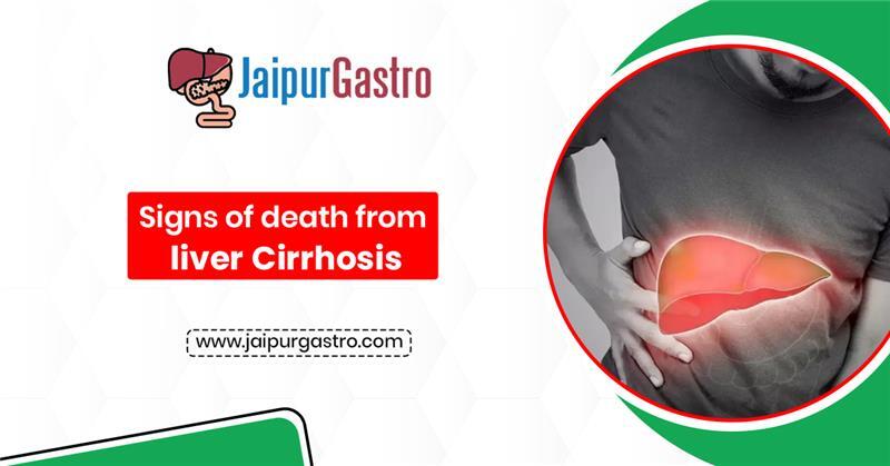 Signs of Death from Liver Cirrhosis